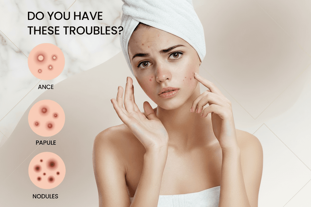JAYSUING Pimple Patches|Mighty Patch Alternative 200patches